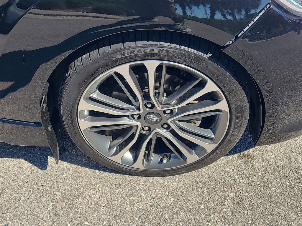 2017 Hyundai VELOSTER Turbo