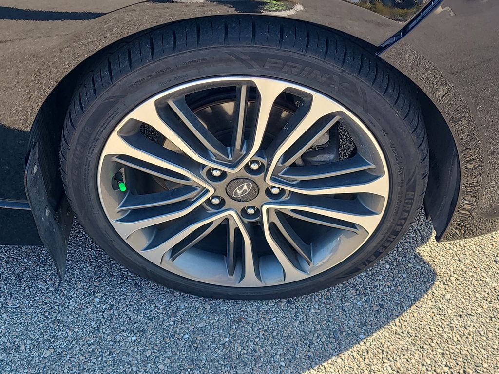 2017 Hyundai VELOSTER Turbo